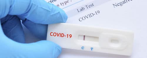 szybki test antygenowy covid